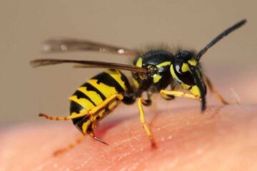 What Most Massachusetts Residents Don’t Realize About Wasp Stings